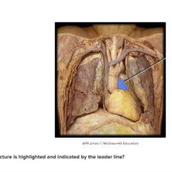 Highlighted vein structure cava vena inferior gonadal which renal mesenteric biology answers questions iliac common answer