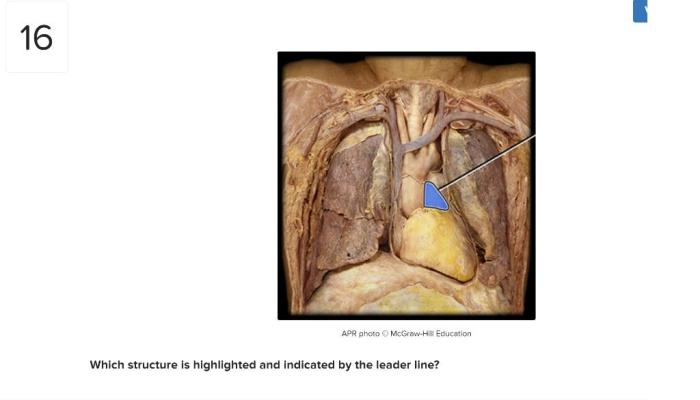 Highlighted vein structure cava vena inferior gonadal which renal mesenteric biology answers questions iliac common answer