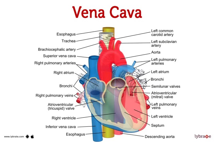 Which structure is highlighted superior vena cava